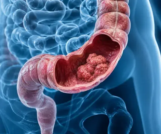 Anatomická ilustrace tlustého střeva